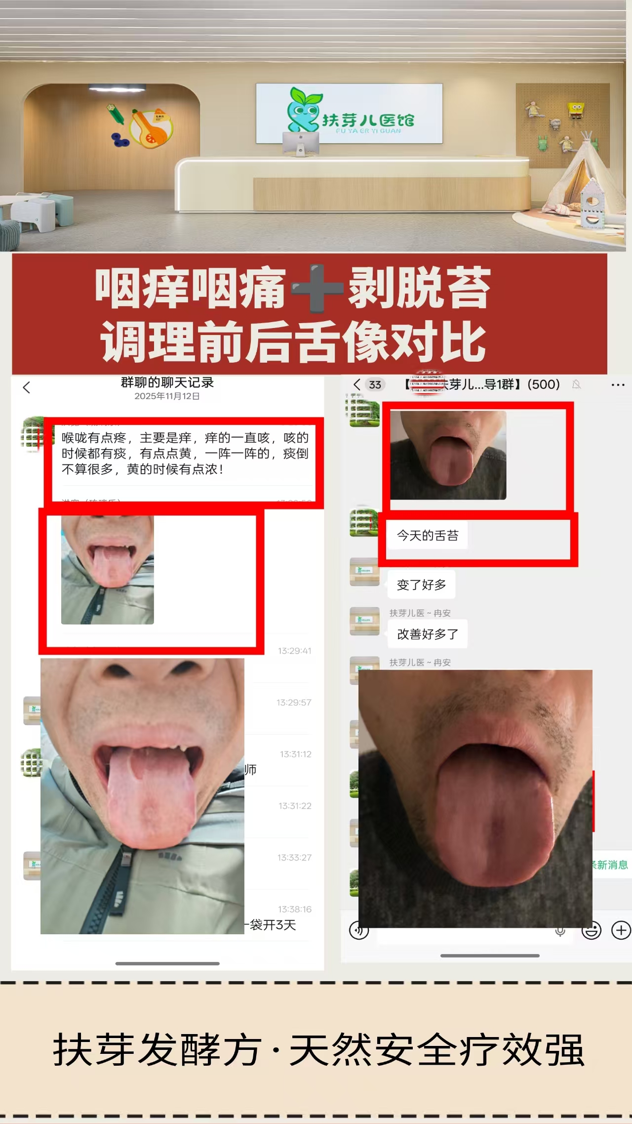 发酵方案例分享