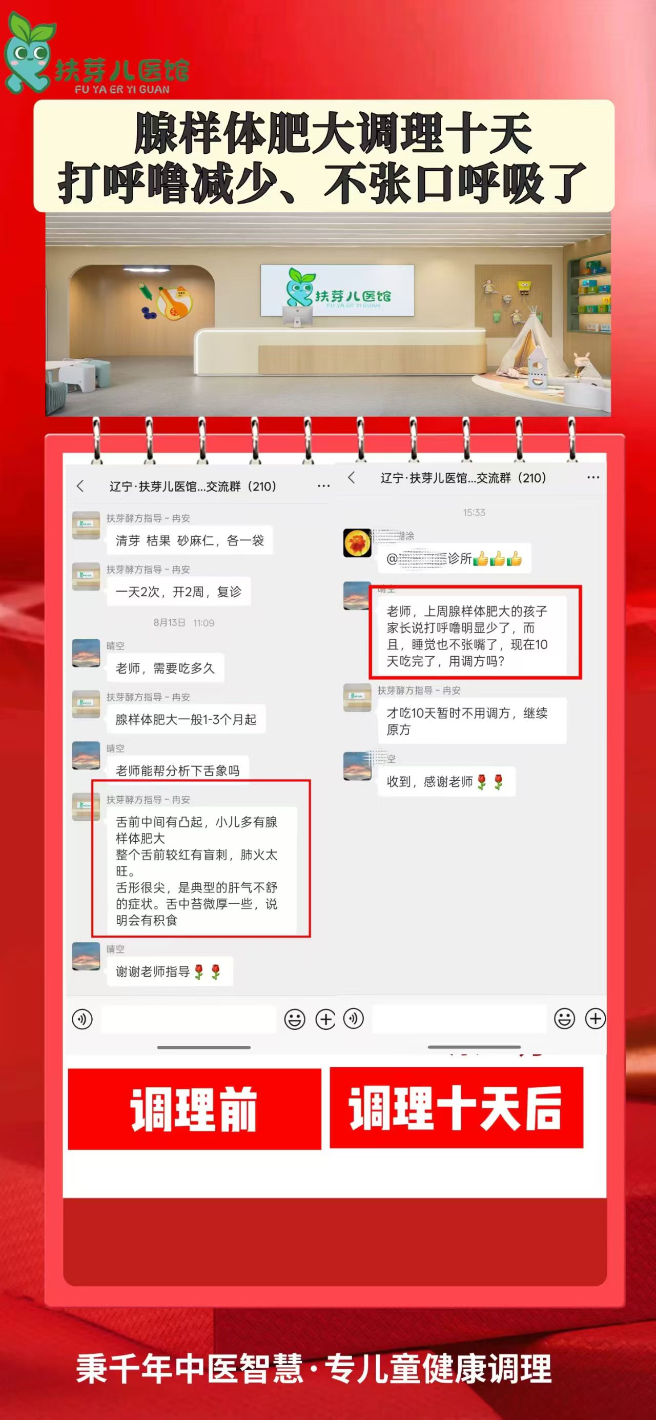 发酵方案例分享-腺样体肥大