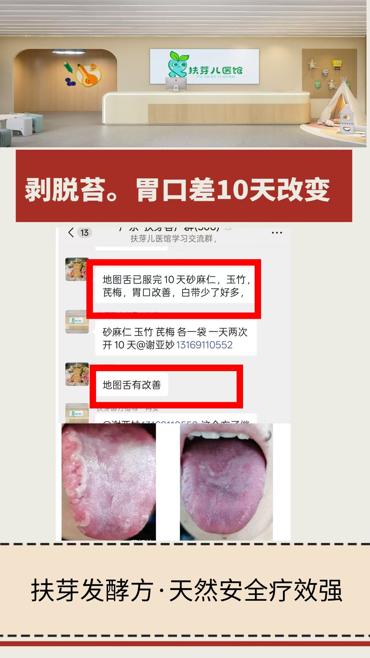 发酵方案例分享-剥落苔、白带异常
