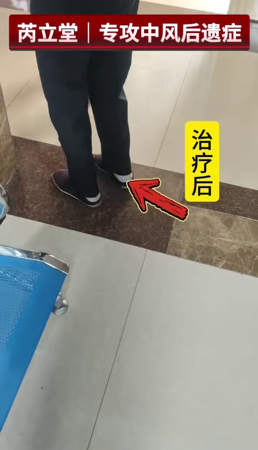 芮立堂针药调节中风后遗症｜腿脚无力