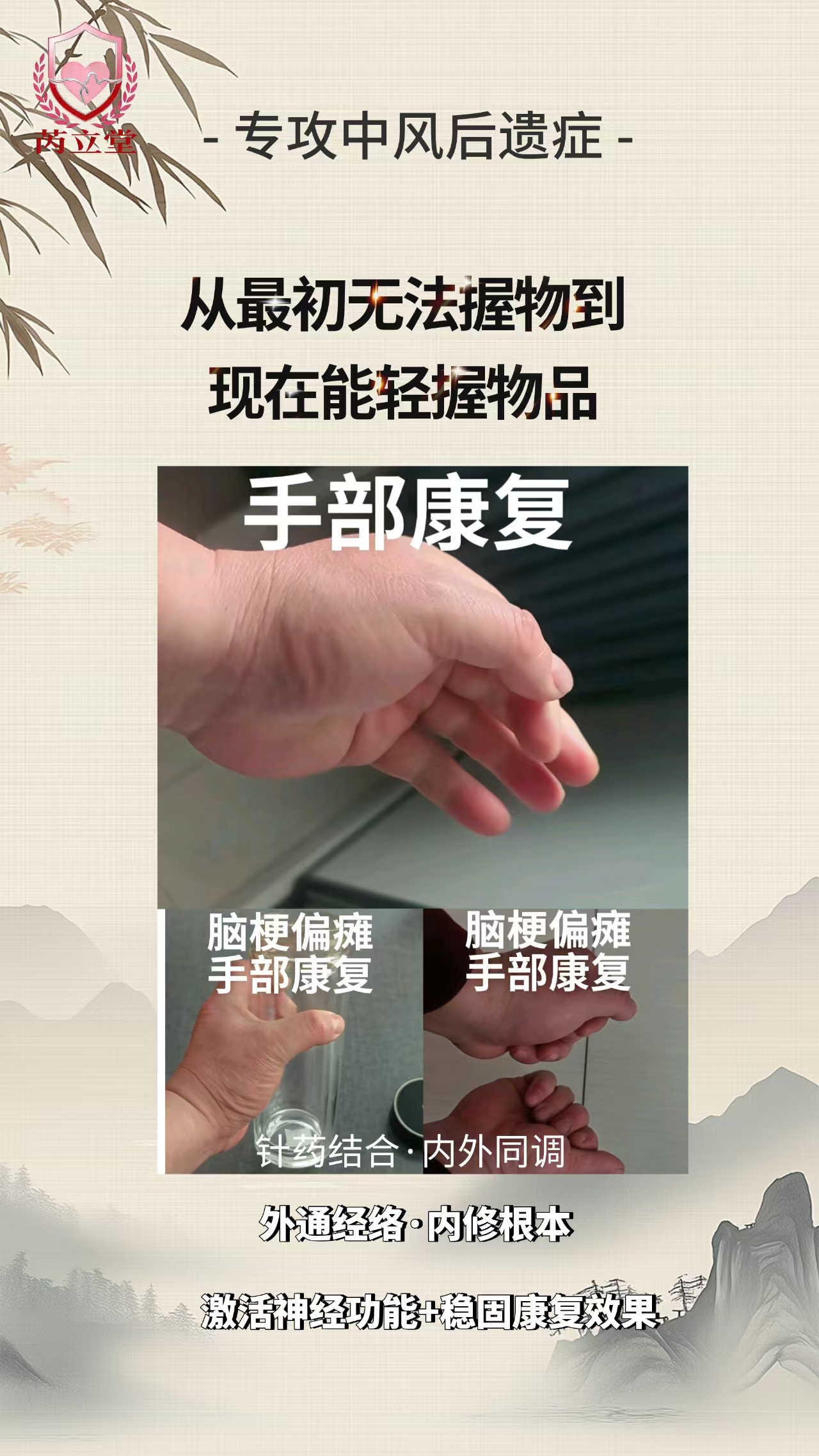 针药调节中风后遗症｜脑梗偏瘫手部康复真实分享