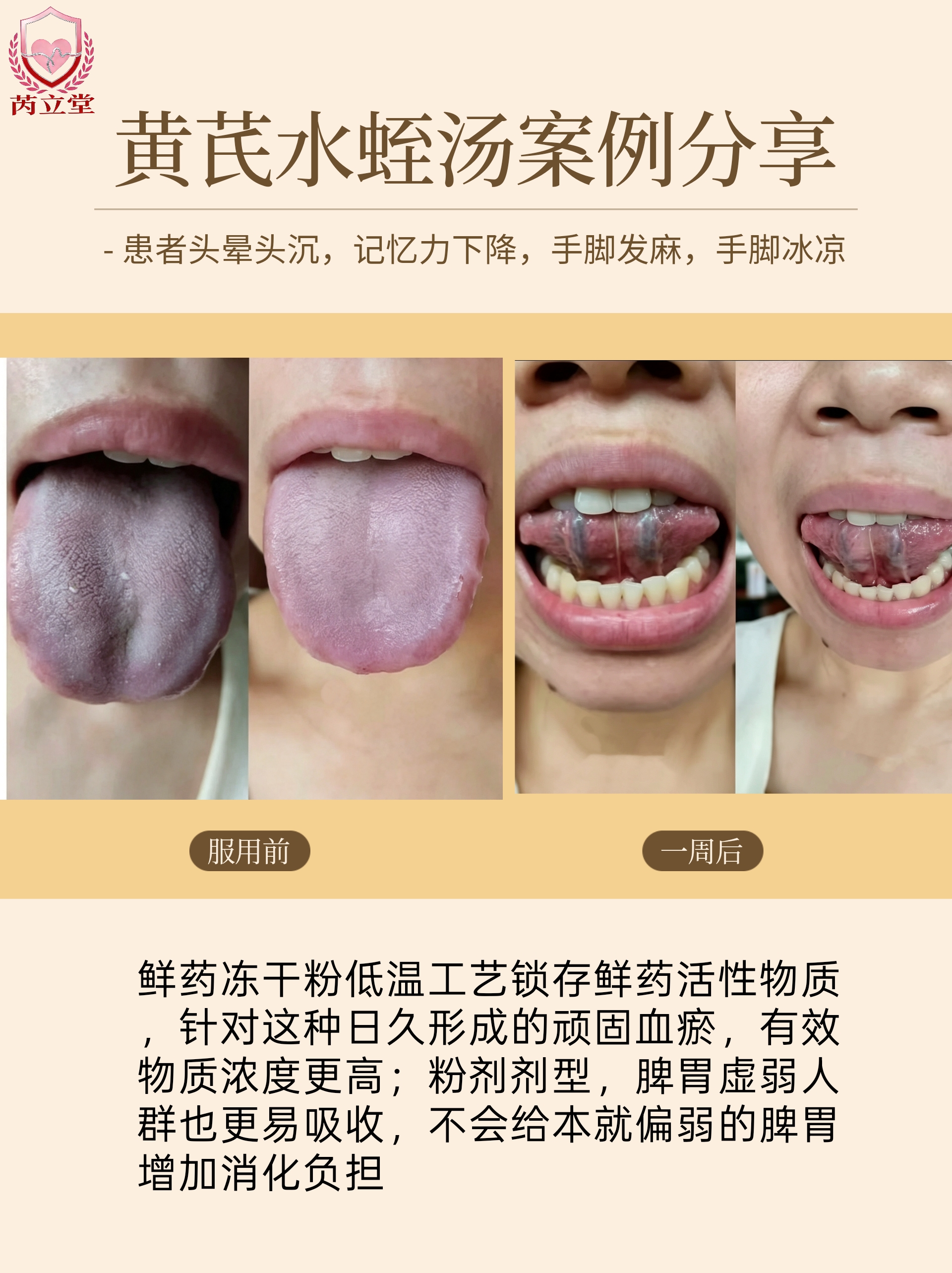 黄芪水蛭汤｜一周改善血瘀体征
